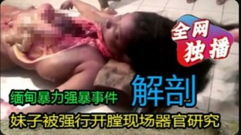【暗网女尸】非洲妹子被开膛验尸现场器官研究视频