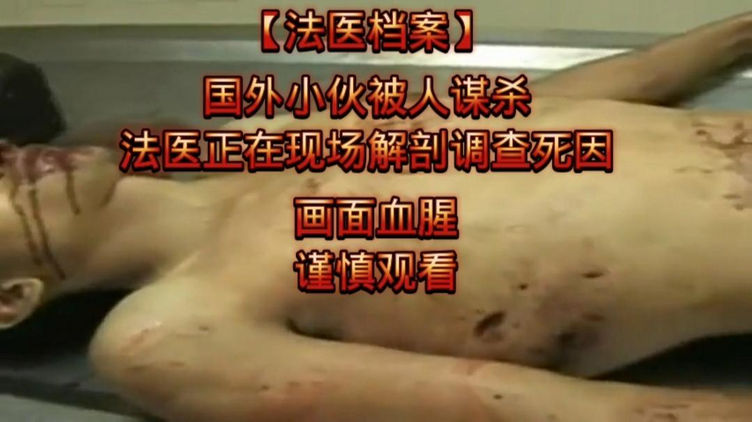 【法医遗失案】(稀有资源)国外小伙被人谋杀法医正在现场解剖调查死因