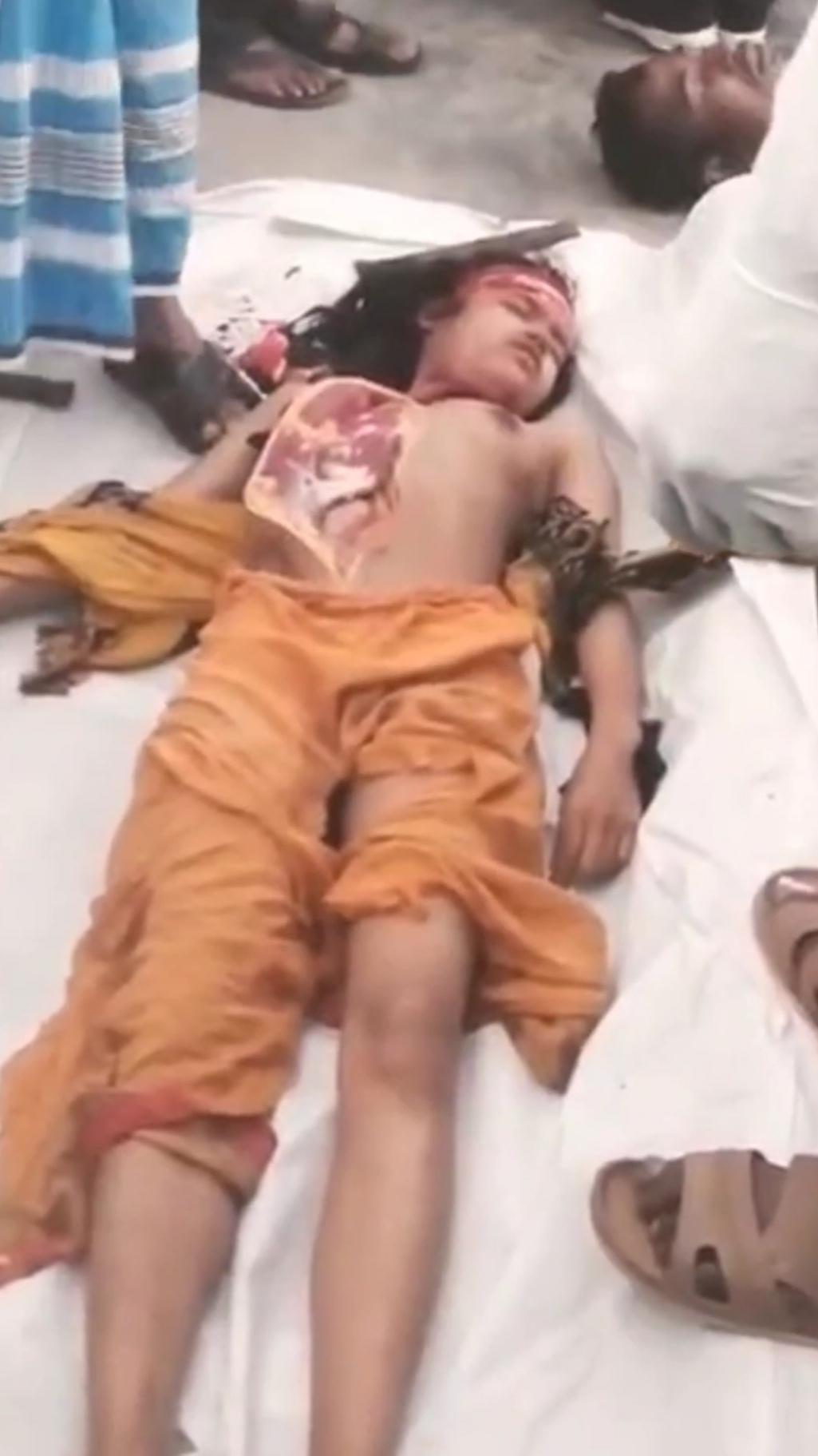 有点残忍血腥高中女孩被奸杀现场解剖